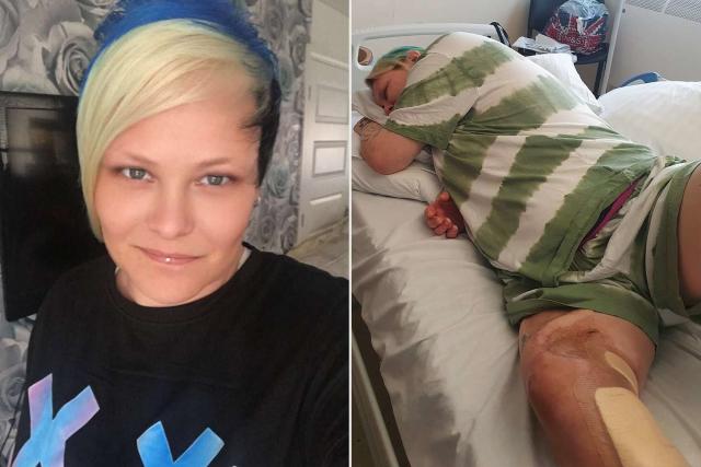 Woman begs docs to amputate leg after scratch from fish hook leaves her  'scared' she'll die - Daily Star