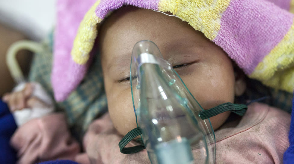 Un bebé con neumonía es nebulizado en Bangladesh