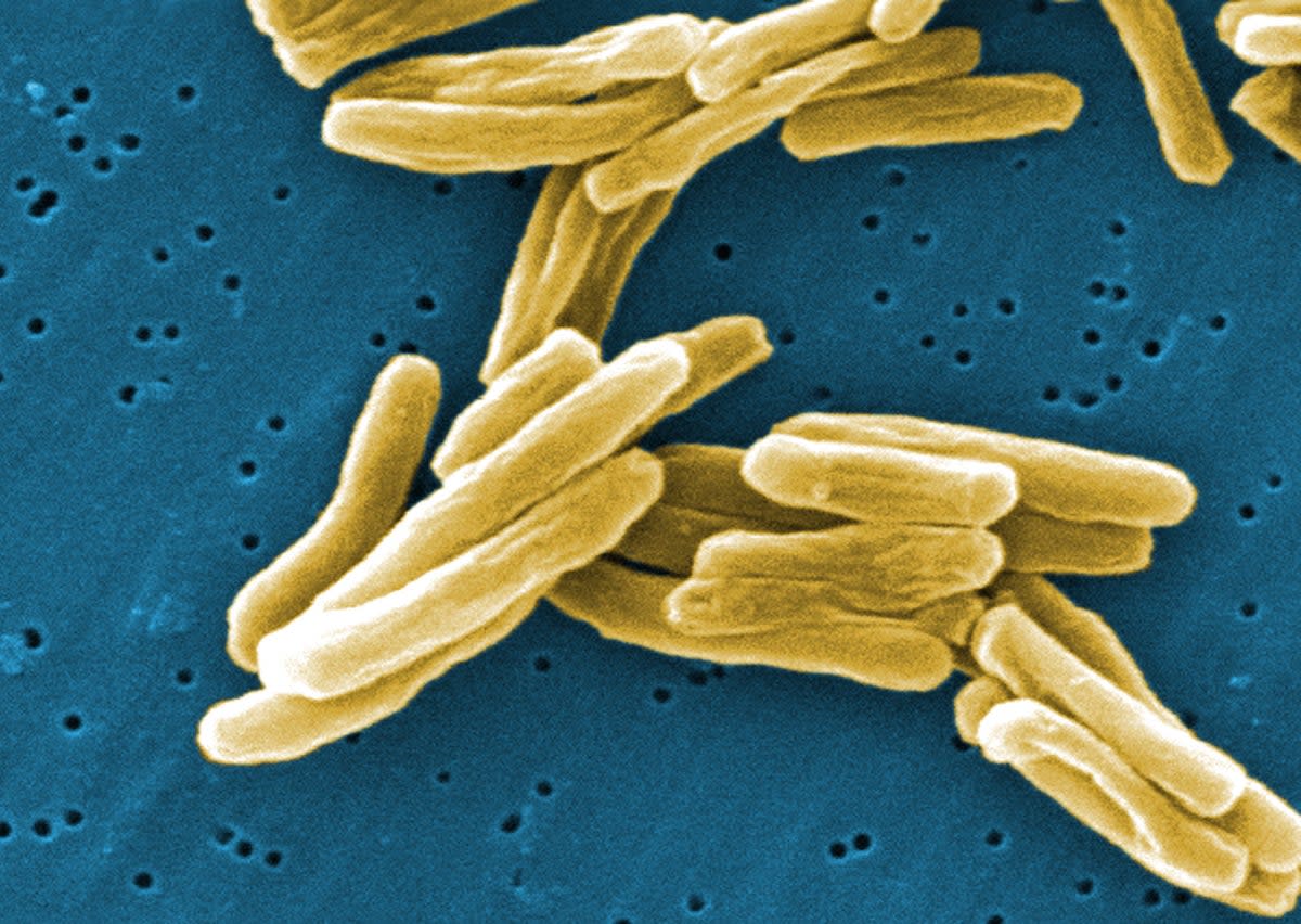 The student died of the disease in October 2021 (File image shows TB cells)  (PA Media)