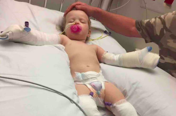 Queensland girl, 2, suffers severe burns after falling into campfire on family trip