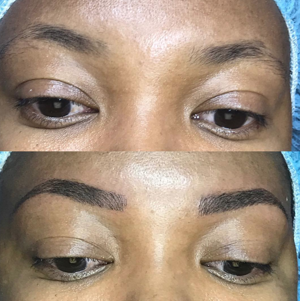 Eyebrows before and after microblading