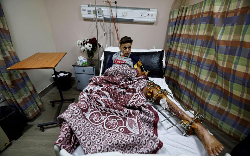 Palestinian boy Youssef, 13, receives medical care at Nasser Institute hospital in Cairo after his evacuation