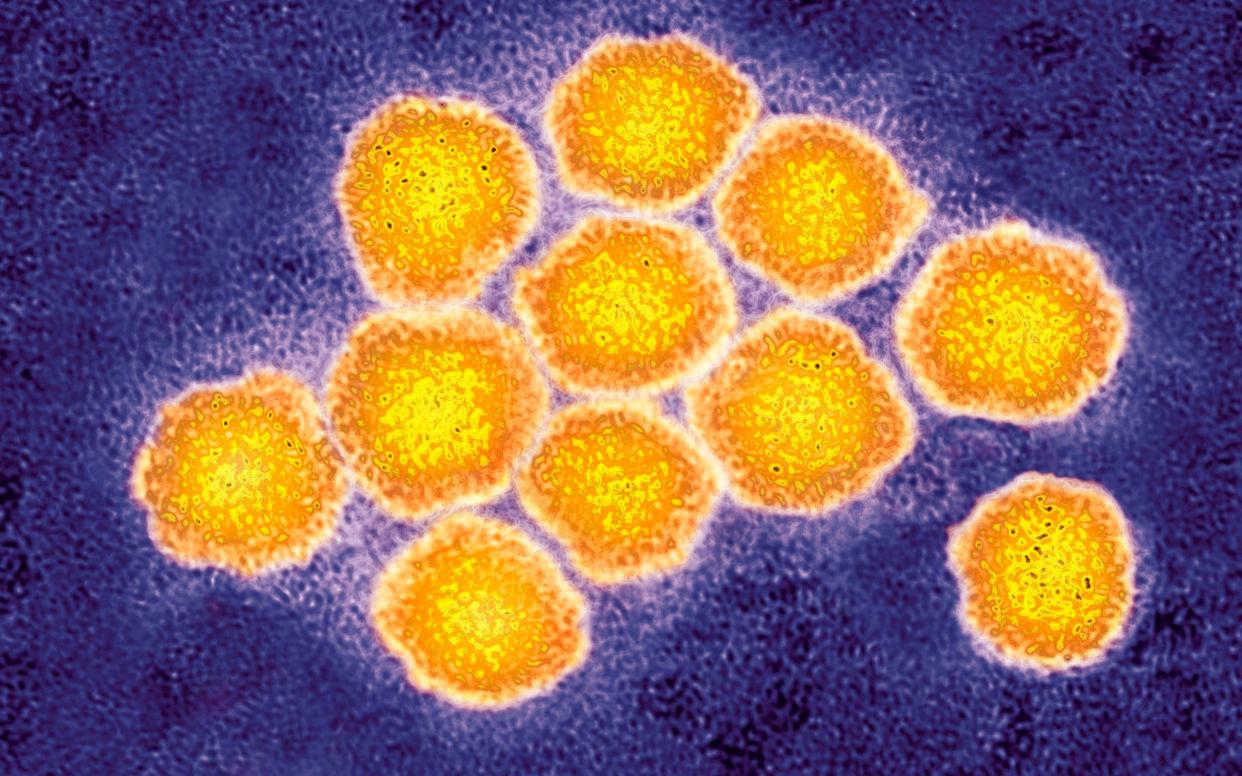 The hepatitis C virus. Almost 5,000 people in the UK contracted HIV or hepatitis C from contaminated treatment.  - Universal Images Group Editorial