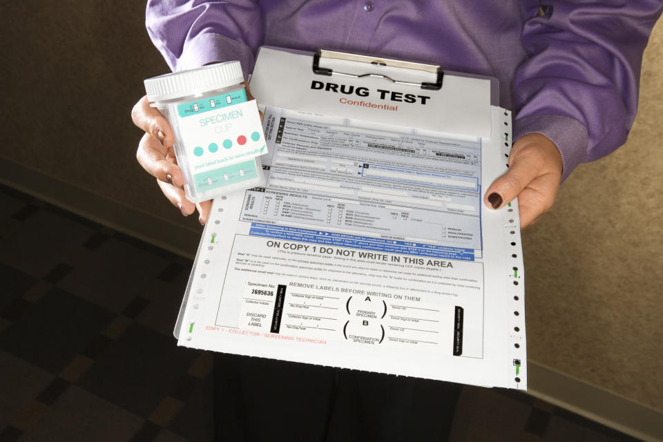 A person holding a clipboard containing drug-testing paperwork, as well as a plastic testing cup.
