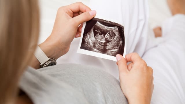Pregnant woman looking at ultrasound photo.