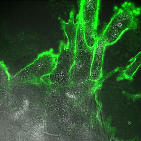 Differentiating HLA-G+ extravillous trophoblast cells growing out from the organoid are seen in this undated image handed out by the University of Cambridge, Britain. Margherita Turco/University of Cambridge/Handout via REUTERS