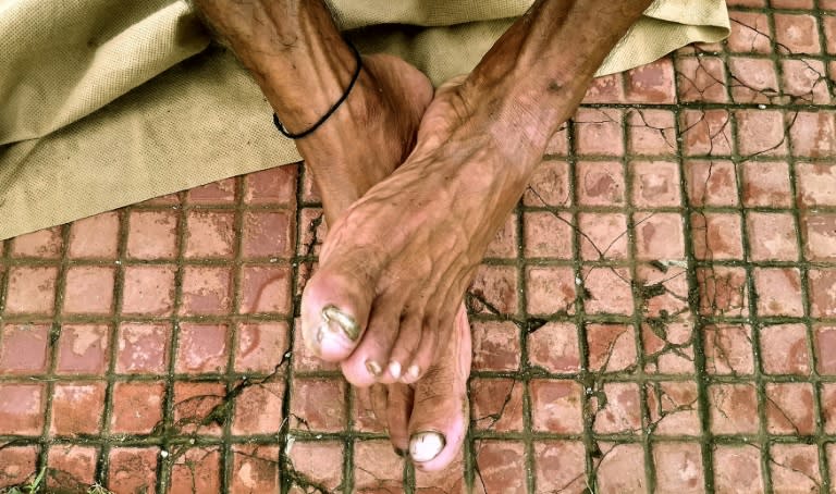 Indian runner Samir Singh rests his feet in Mumbai