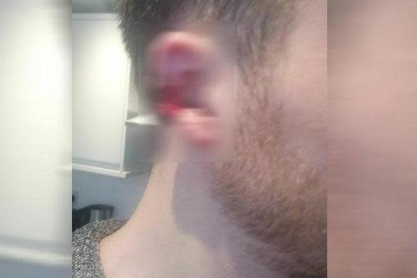 The assault left the victim with a bloodied ear (BTP)