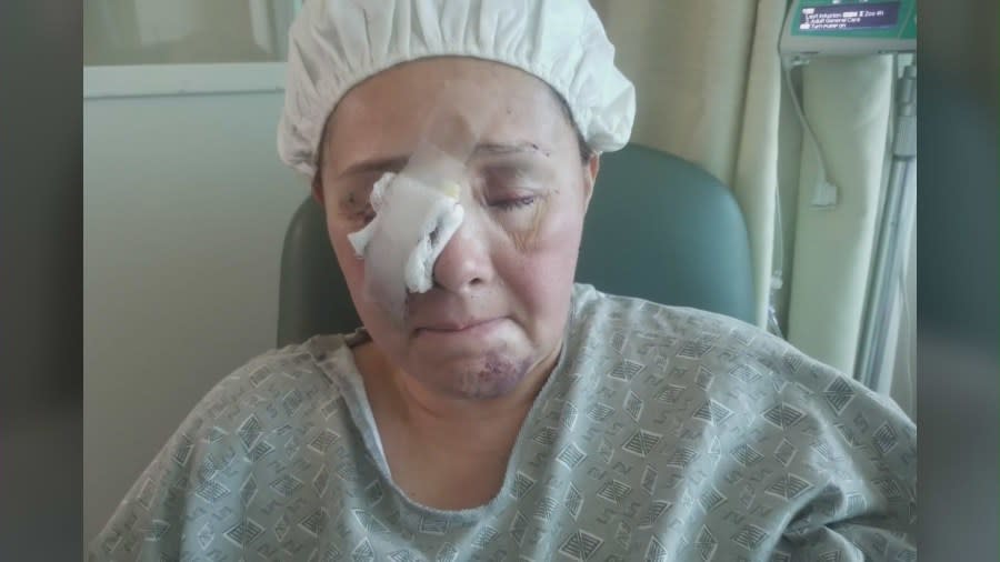 Norwalk woman recovering after being beaten unconscious during armed home invasion, kidnapping