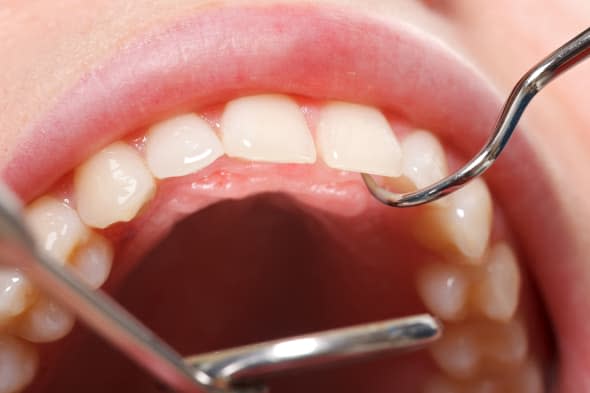 Periodic comprehensive dental examination to have a healthy mouth and teeth