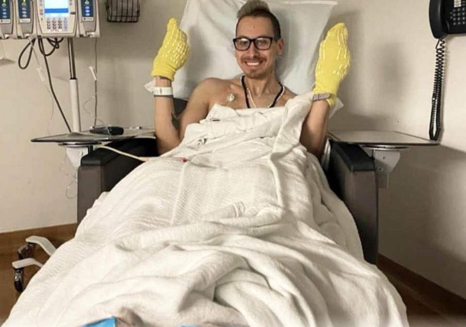When Lopez began undergoing chemotherapy in January 2020, his hands and feet were wrapped as part of an experimental treatment to prevent peripheral neuropathy, a common side effect of chemo. (Courtesy Chris Lopez)