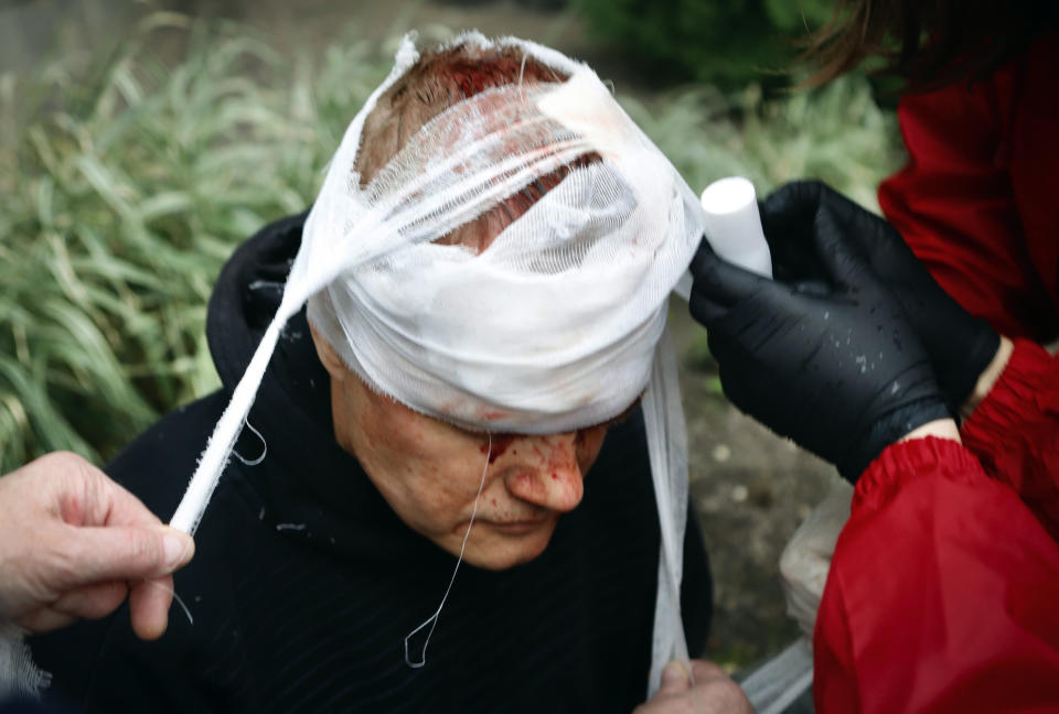 People provide a health care to a wounded protester during an opposition rally to protest the official presidential election results in Minsk, Belarus, Sunday, Oct. 11, 2020. Belarus' authoritarian president Alexander Lukashenko on Saturday visited a prison to talk to opposition activists, who have been jailed for challenging his re-election that was widely seen as manipulated and triggered two months of protests. (AP Photo)