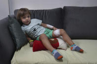 CORRECTS THE FAMILY NAME OF THE BOY - Three-year-old Abed Itani lies on a sofa at his family house in Beirut, Lebanon, Tuesday, Aug. 11, 2020. Abed was playing with his Lego blocks when the huge blast ripped through Beirut, shattering the nearby glass doors. He had cuts on his tiny arms and feet, a head injury, and was taken to the emergency room, where he sat amid other bleeding people. (AP Photo/Bilal Hussein)