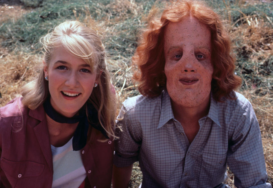 Laura Dern and Eric Stoltz star in <em>Mask.</em> (Photo: Courtesy Everett Collection)