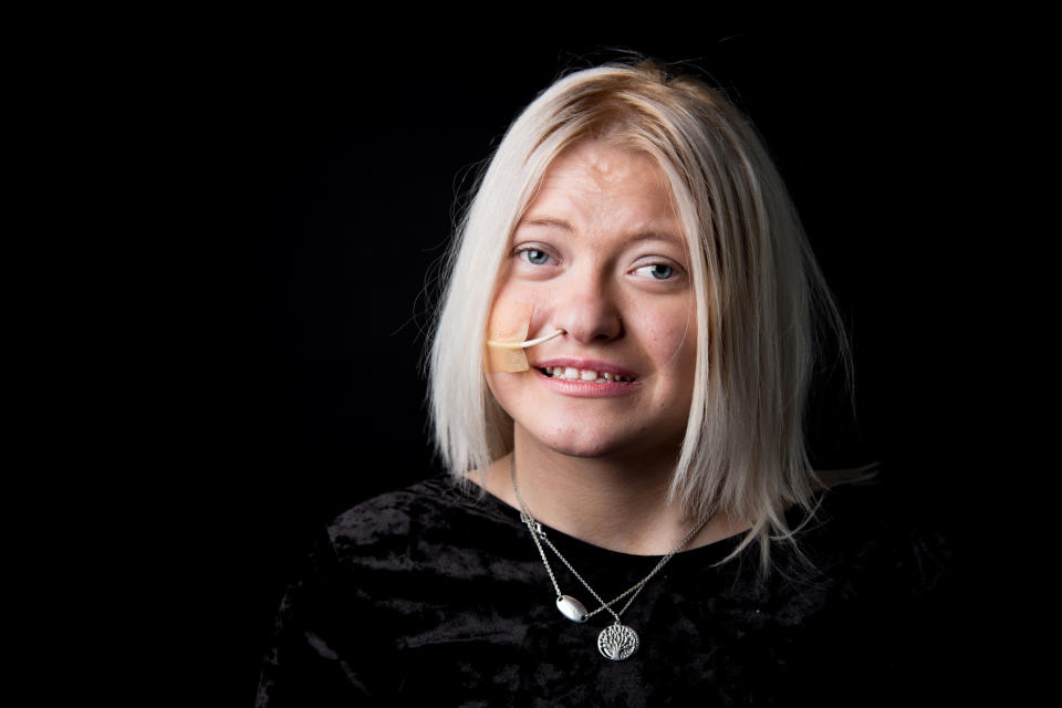 "Olivia is 17 and does not have a diagnosis." (Photo: Ceridwen Hughes)