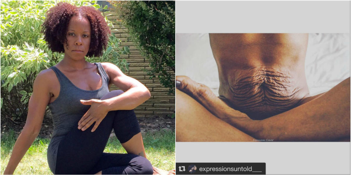 Mums share pictures of their postpartum bodies to help others embrace  theirs, The Independent