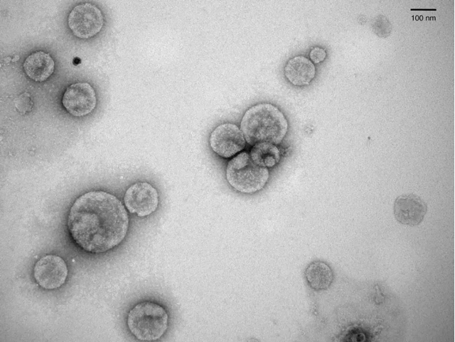 <span class="caption">Vésicules extracellulaires libérées par le parasite Leishmania, vues en microscopie électronique.</span> <span class="attribution"><span class="source">Fernandez-Prada Lab, 2020</span></span>