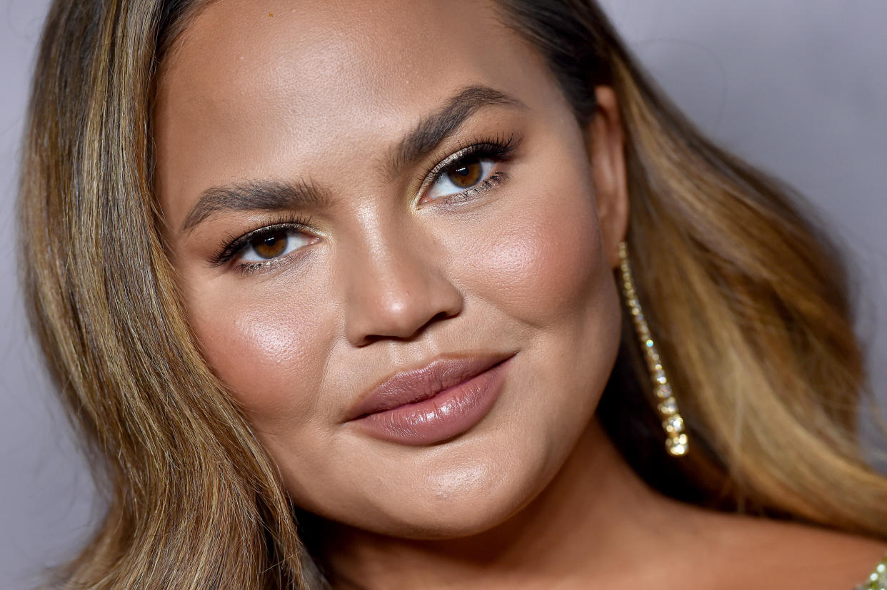 Chrissy Teigen says parents who use baby formula shouldn't be shamed. (Photo: Axelle/Bauer-Griffin/FilmMagic)