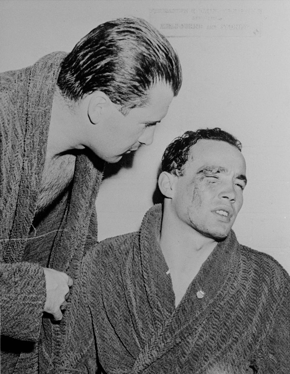 Hungarian water polo player Ervin Zador, his eye cut during a fight with a Russian player in the closing stages of the Hungary vs. Russia water polo match is consoled by Hungarian team captain Dezso Gyarmati after the incident. The Melbourne Olympics were already quite unique before they started. They were the first games held in the southern hemisphere, and ran from Nov. 22 to Dec. 8 to take in the Australian summer. (AP Photo)