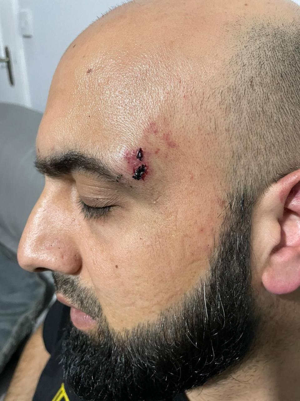 Sharaz Hussain was left with a cut above his eye after being thrown to the ground by armed police. (Reach)