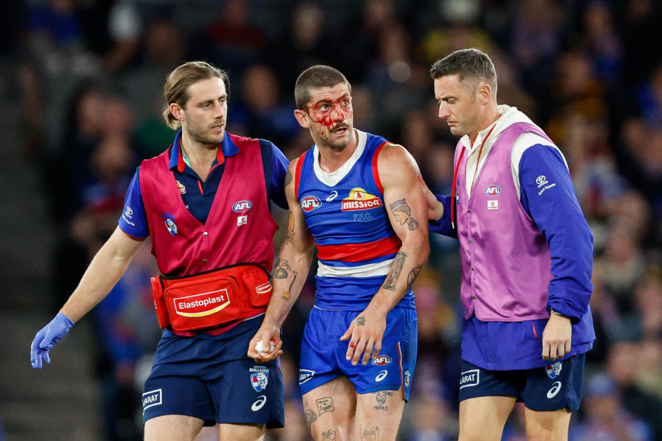 MELBOURNE, AUSTRALIA - MAY 05: Tom Liberatore of the Bulldogs leaves the field under the blood rule during the 2024 AFL Round 08 match between the Western Bulldogs and the Hawthorn Hawks at Marvel Stadium on May 05, 2024 in Melbourne, Australia. (Photo by Dylan Burns/AFL Photos via Getty Images)