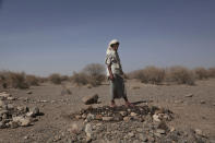 <p>Said Mohammed, whose 8-month-old son Fadl starved to death, visits his sonâs grave in the Great Valley outside the Yemeni town of Mocha in this Feb. 10, 2018 photo. Fadlâs mother gave birth to him under a tree as she fled fighting. Eight months later, at the time of his death, the baby boy weighed 2.9 kilograms (6 pounds), a third of the normal weight for his age. (Photo: Nariman El-Mofty/AP) </p>