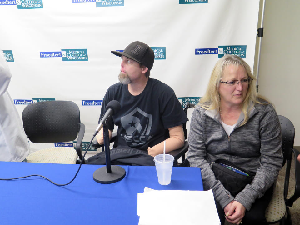 Greg Manteufel, left, and his wife Dawn Manteufel, speak to reporters on Tuesday, Oct.2, 2018, in Milwaukee, about his recovery from a rare blood infection that led to the amputation of part of his forearms and legs. Doctors say the blood infection was caused by dog saliva. (AP Photo/Ivan Moreno)