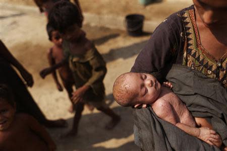 A Rohingya woman shows her baby, who is suffering from a skin infection, at the Thet Kae Pyin camp for internally displaced people in Sittwe, Rakhine state, April 24, 2014. REUTERS/Minzayar