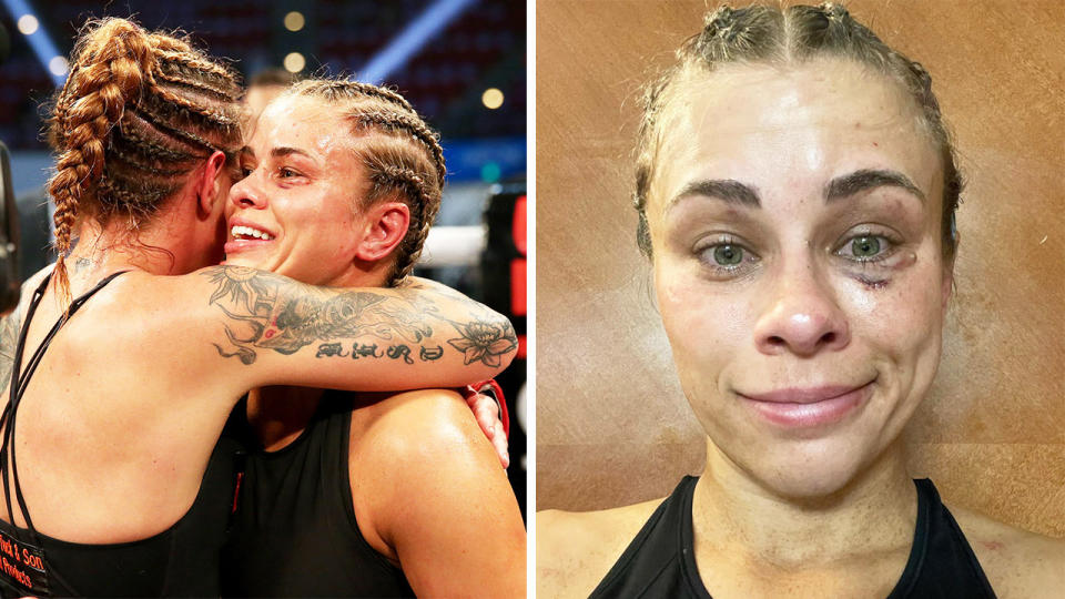 Paige VanZant (pictured right) showing her bruises and (pictured left) hugging Britain Hart after her bare-knuckle boxing debut against.