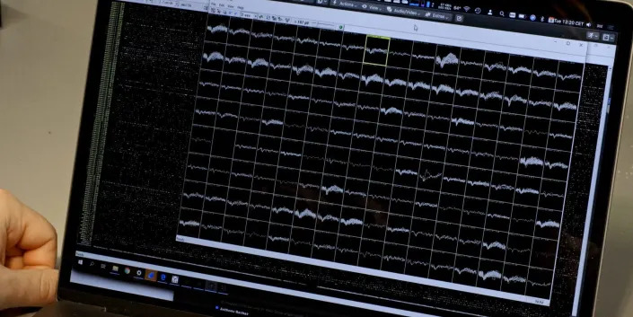 Neural data recorded by the implant is shown on a computer screen as a series of waves.