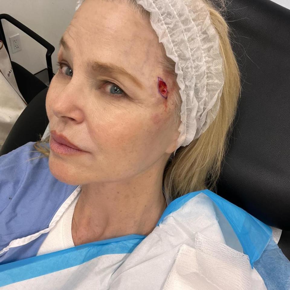 Christie Brinkley revealed she’s been diagnosed with skin cancer on Wednesday. christiebrinkley/Instagram