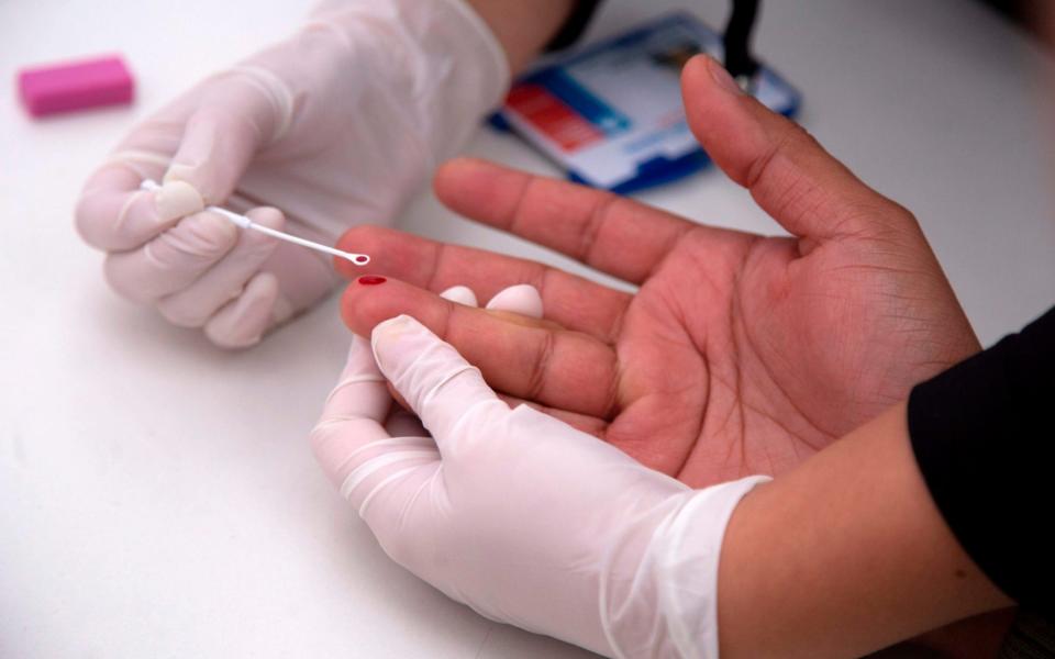 A man undergoes a rapid test for HIV - AFP