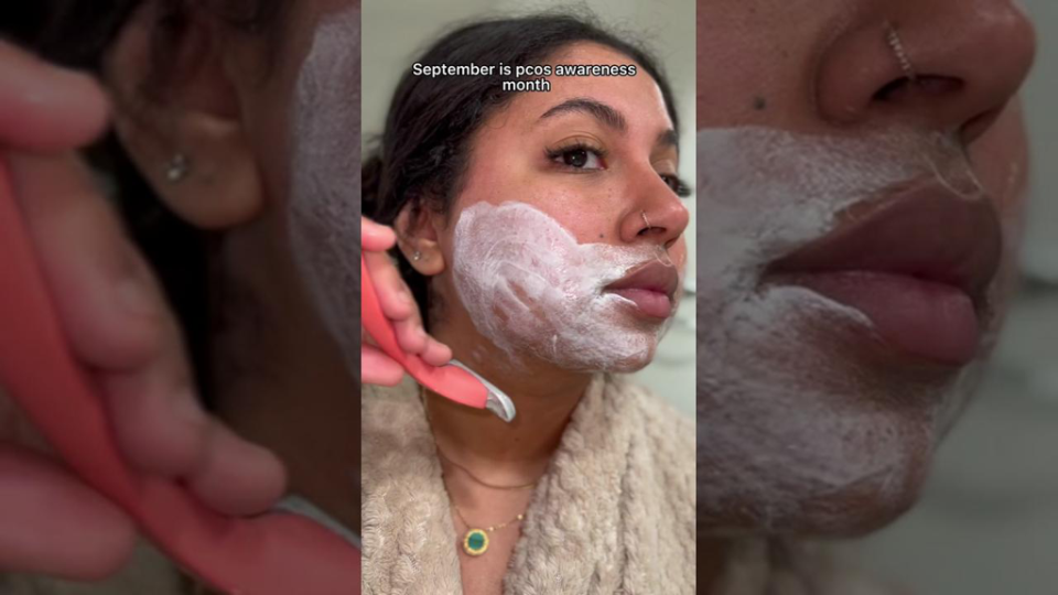 Thalia LeBlanc, shown here shaving her facial hair, which is a symptom of PCOS, says she hopes her videos help others struggling with polycystic ovary syndrome.