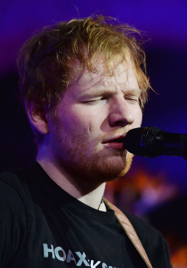 Ed Sheeran performs at East Anglia's Children's Hospices gala dinner in London in 2016, where his scar still looks recent. 