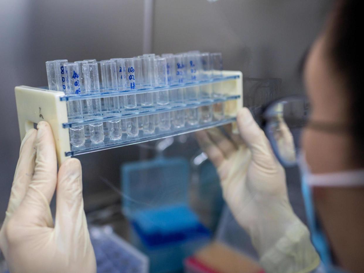 Testing generated antibodies in mice that neutralise coronavirus in human cells: NICOLAS ASFOURI/AFP via Getty Images