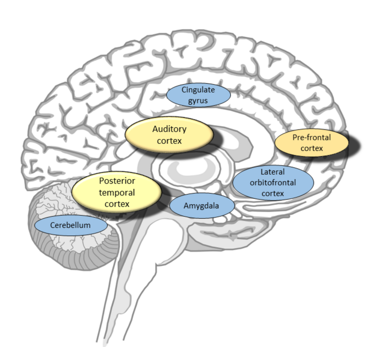 <span class="caption">Brain regions linked to listening to music.</span> <span class="attribution"><span class="license">Author provided</span></span>