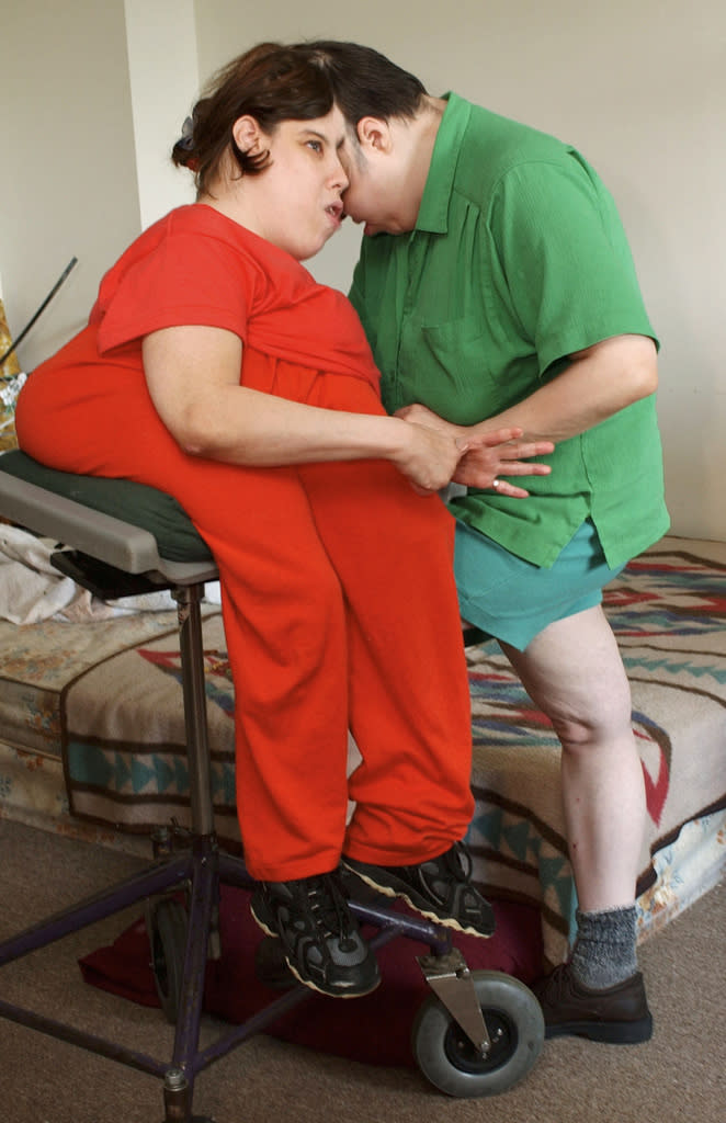 FILE – Conjoined 40-year-old twins George, left, and Lori Schappell are seen in their Reading, Pa., home, Thursday, Aug. 8, 2002. Lori and George Schappell, who pursued separate careers, interests and relationships during lives that defied medical expectations, died April 7, 2024, at the Hospital of the University of Pennsylvania. They were 62. (AP Photo/Brad C. Bower, File)
