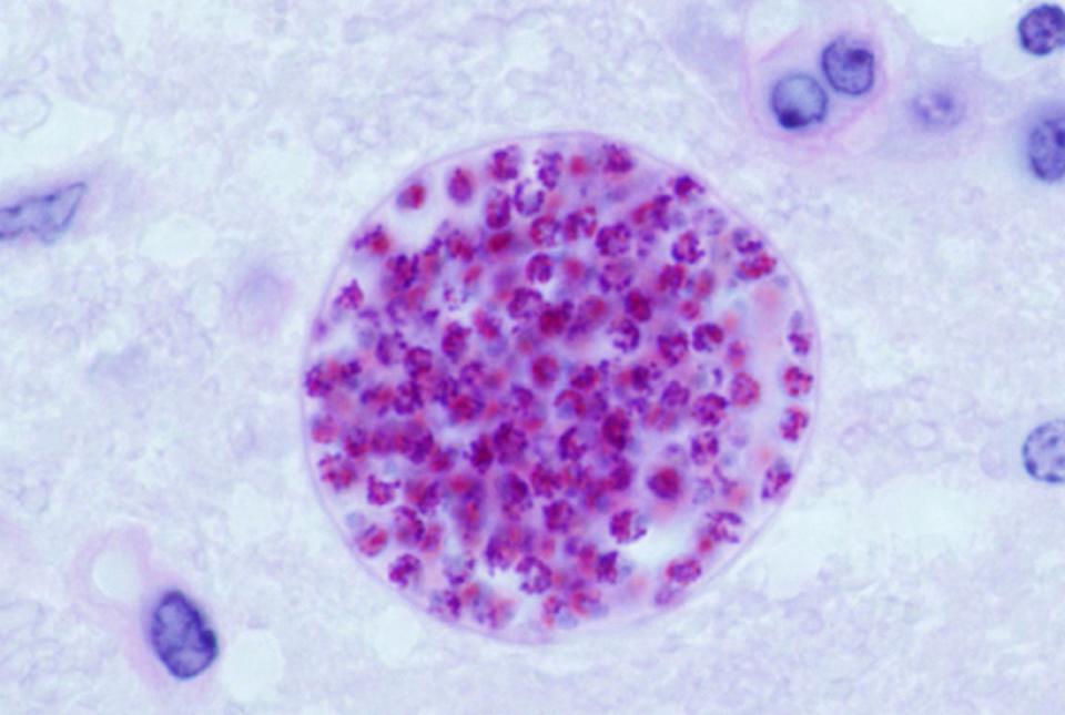 Quiste microscópico de <em>Toxoplasma gondii</em> desarrollado en el cerebro de un ratón. <a href="https://www.ars.usda.gov/oc/images/photos/sep08/d1210-1/" rel="nofollow noopener" target="_blank" data-ylk="slk:Jitinder P. Dubey / USDA;elm:context_link;itc:0;sec:content-canvas" class="link ">Jitinder P. Dubey / USDA</a>