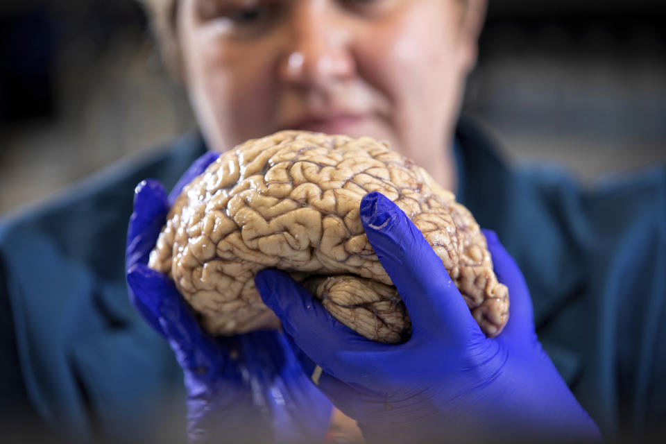 In this Aug. 14, 2019 photo provided by the University of Kentucky, Donna Wilcock, of the Sanders-Brown Center on Aging, holds a brain in her lab in Lexington, Ky. She says that contrary to popular perception, "there are a lot of changes that happen in the aging brain that lead to dementia in addition to plaques and tangles." (Mark Cornelison/University of Kentucky via AP)