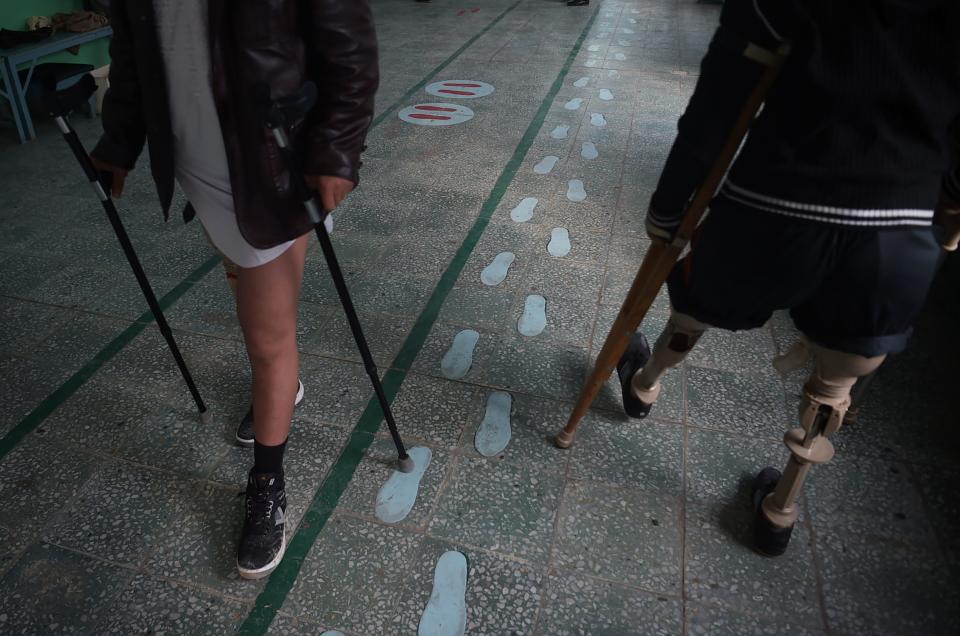 Afghan amputees practice walking with their prosthetic legs on Feb. 13, 2018, at a hospital run by the International Committee of the Red Cross for war victims and the disabled in Kabul.