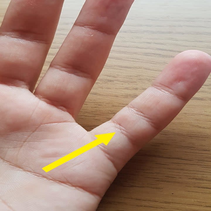 An extra joint crease on someone's finger