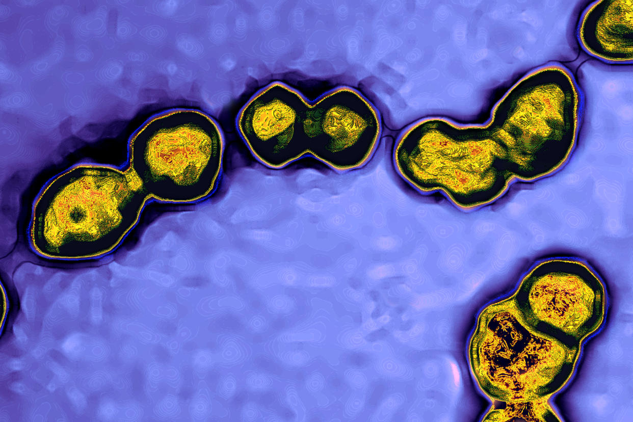 Streptococcus: Spheroidal Bacteria Which Group Characteristically In Chains Resembling A String Of Pearls. Streptococcus Contains A Variety Of Species, Some Of Which Cause Disease In Humans And Animals Such As Scarlet Fever, Strep Throat, Blood Poisoning, Meningitis, Newborn Infections, Endocarditis, Pneumonia, Erysipelas, Various Rashes, Erythema Nodosa, Anaphylactoid Purpura, And Urinary Tract Infections. (Photo By BSIP/UIG Via Getty Images)