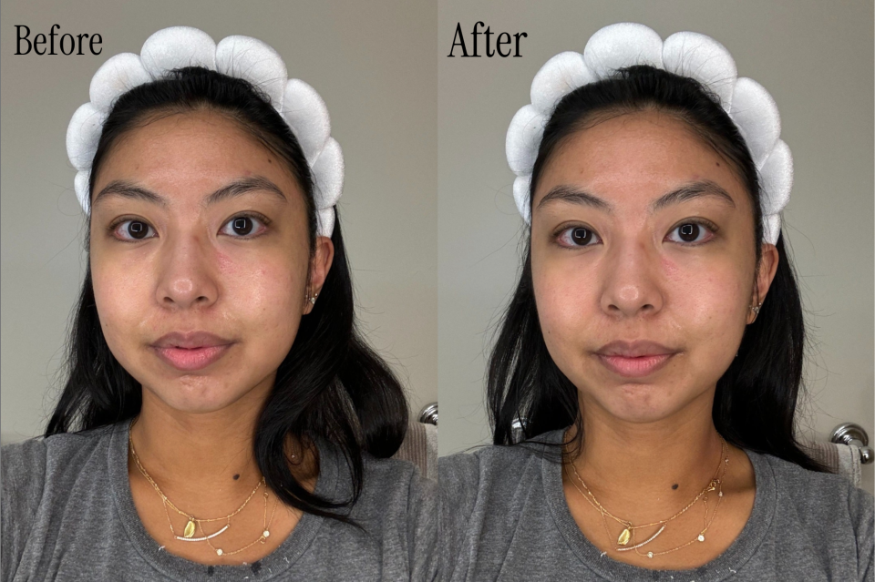 <h1 class="title">Medicube Review Before and After - 1</h1><cite class="credit">Original image by *Glamour* beauty editor Ariana Yaptangco</cite>