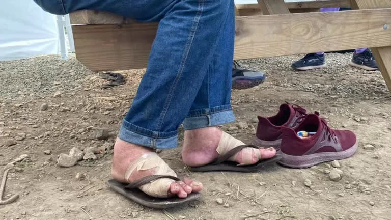 Los migrantes llegan con los pies heridos a los puestos de atención en el Darién por las largas caminatas