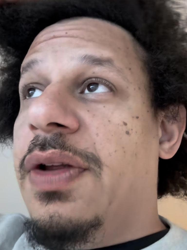 Comedian Eric André claimed he was the victim of racial discrimination at Melbourne Airport on Monday. Image: Instagram.