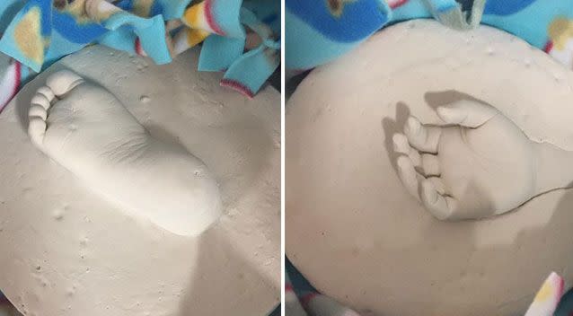 Doctors made clay imprints of one of Logan's hands and feet. Source: Facebook