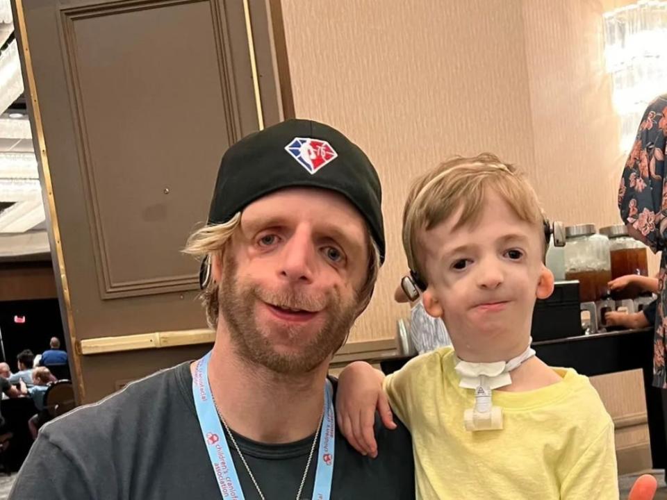 Jonathan Lancaster poses with a little boy who has Treacher Collins syndrome like him.