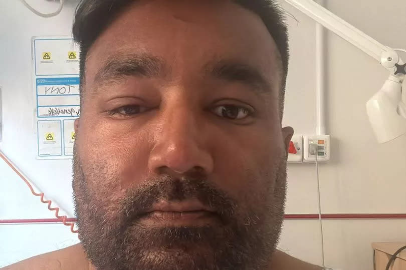 Tony Varghese, 41, is recovering in hospital from his allergic reaction