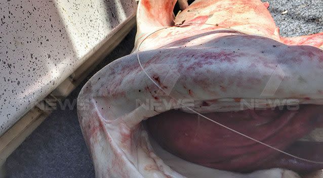 The five-foot shark shark bit the New Gisborne man on the arm up to his elbow. Pictures: 7 News