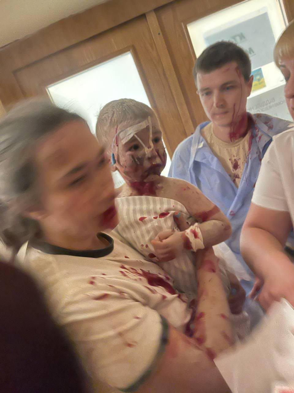 An adviser to Volodymyr Zelensky shared this image of a child caught up in the horror (Ukraine President’s Office)